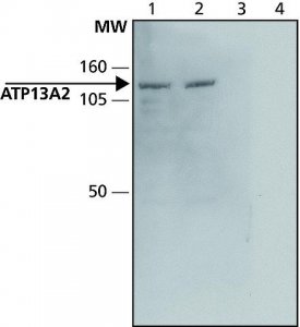 Anti-ATP13A2 (C-terminal) antibody produced in rabbit 